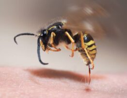european wasp sting